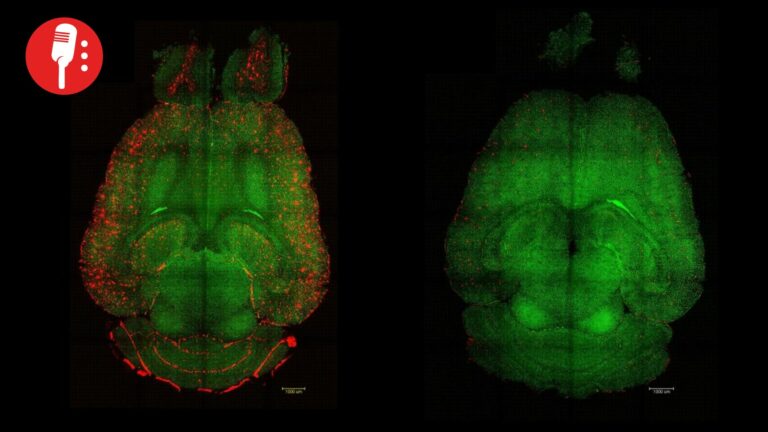 Nanopartículas logran revertir el alzhéimer en modelos animales