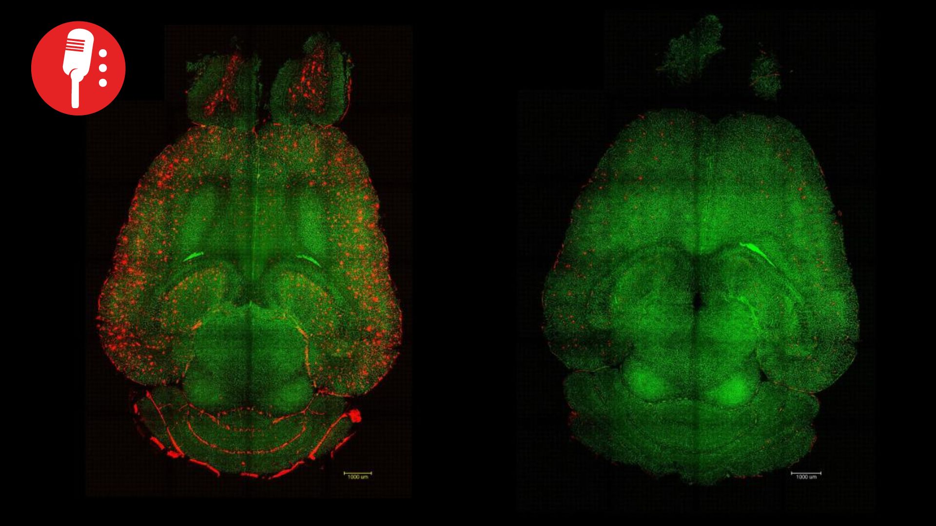 Nanopartículas logran revertir el alzhéimer en modelos animales