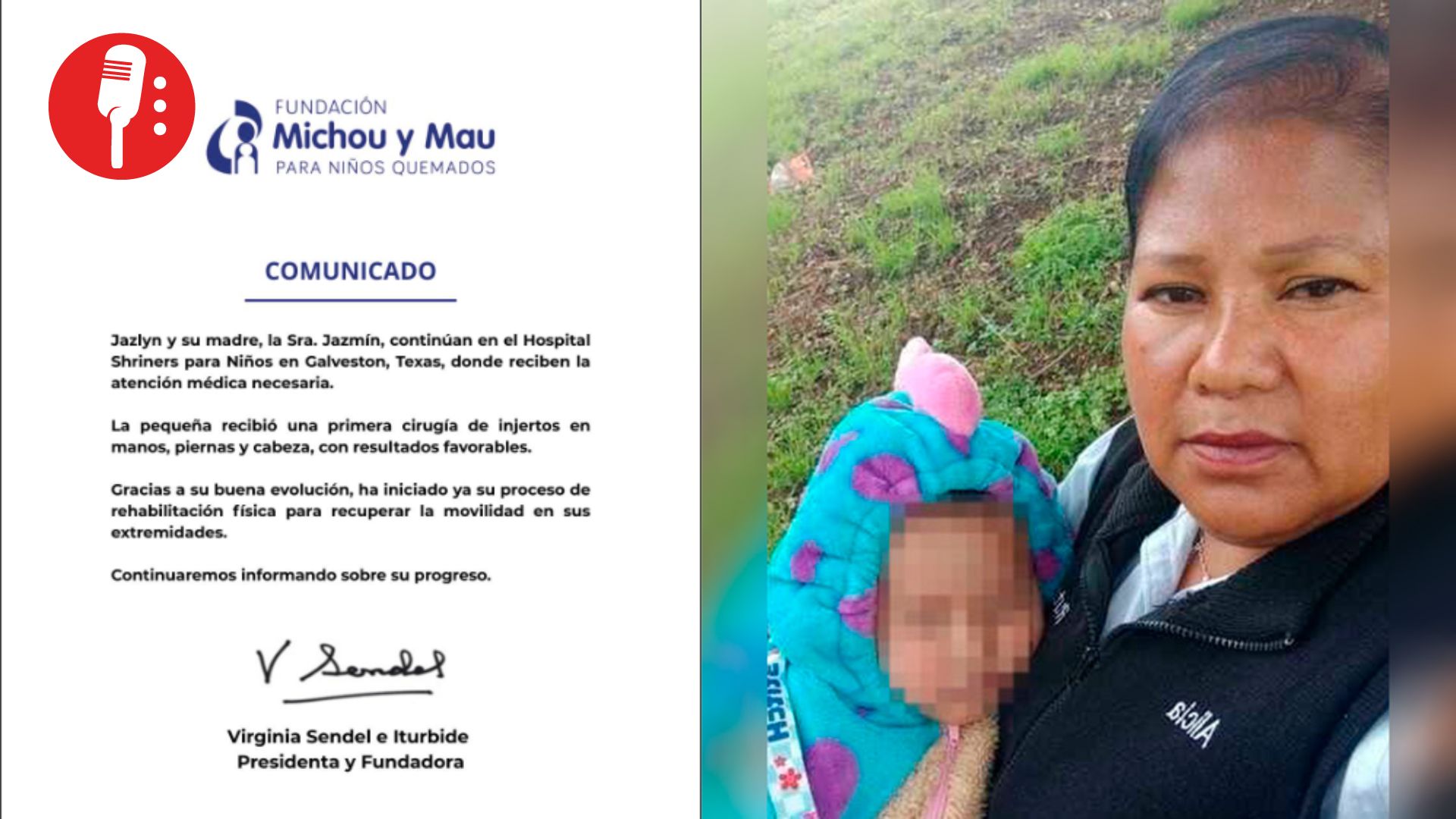 Bebé Jazlyn, víctima de explosión en Iztapalapa, evoluciona favorablemente tras primera cirugía en Texas