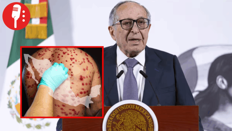 Casos activos de sarampión muestran tendencia a la baja en México