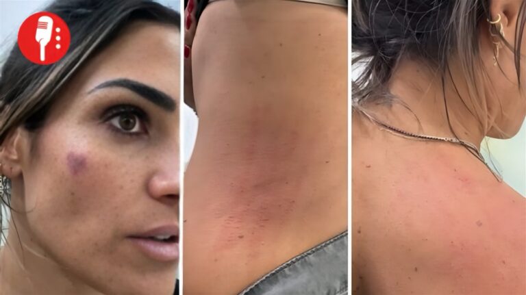 Redes exponen las lesiones de Alessandra Rojo