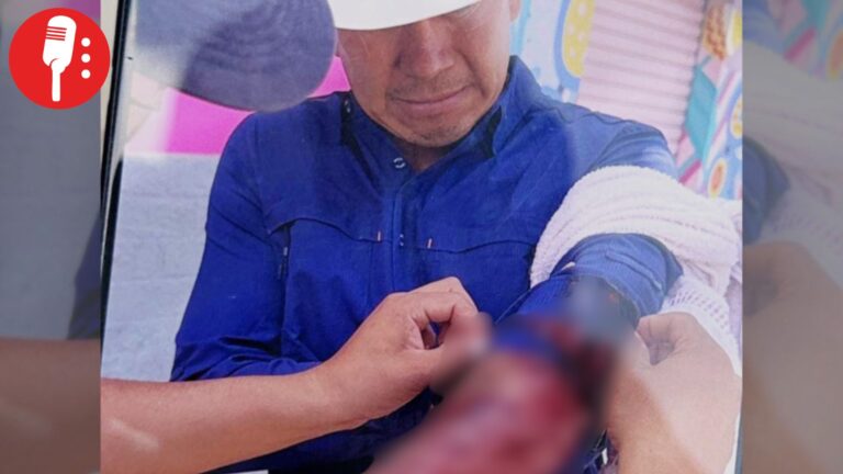 Atacan a balazos al alcalde de Miahuatlán; resulta herido junto con trabajador municipal