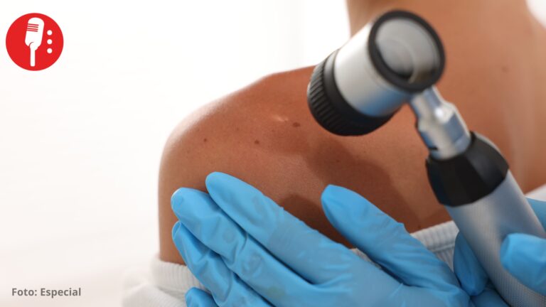Merck y Moderna anuncian resultados positivos de vacuna contra cáncer de piel