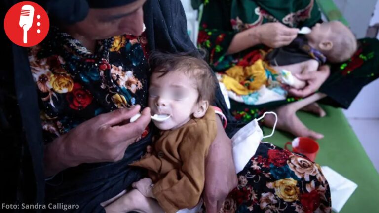 Desnutrición infantil alcanza niveles críticos en Afganistán