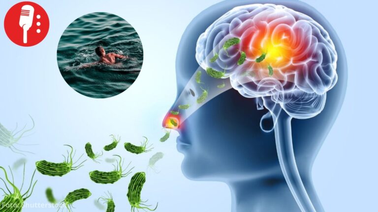 Ameba “comecerebros” causa primera muerte registrada en Yucatán