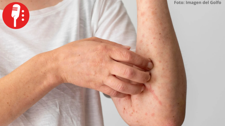 Desinformación antivacunas dispara brote por sarampión en Nueva York